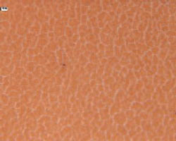 This photomicrograph shows varnish material on an analysis membrane (0.45-micron porosity) at 100x magnification. This photomicrograph shows varnish material on an analysis membrane (0.45-micron porosity) at 100x magnification