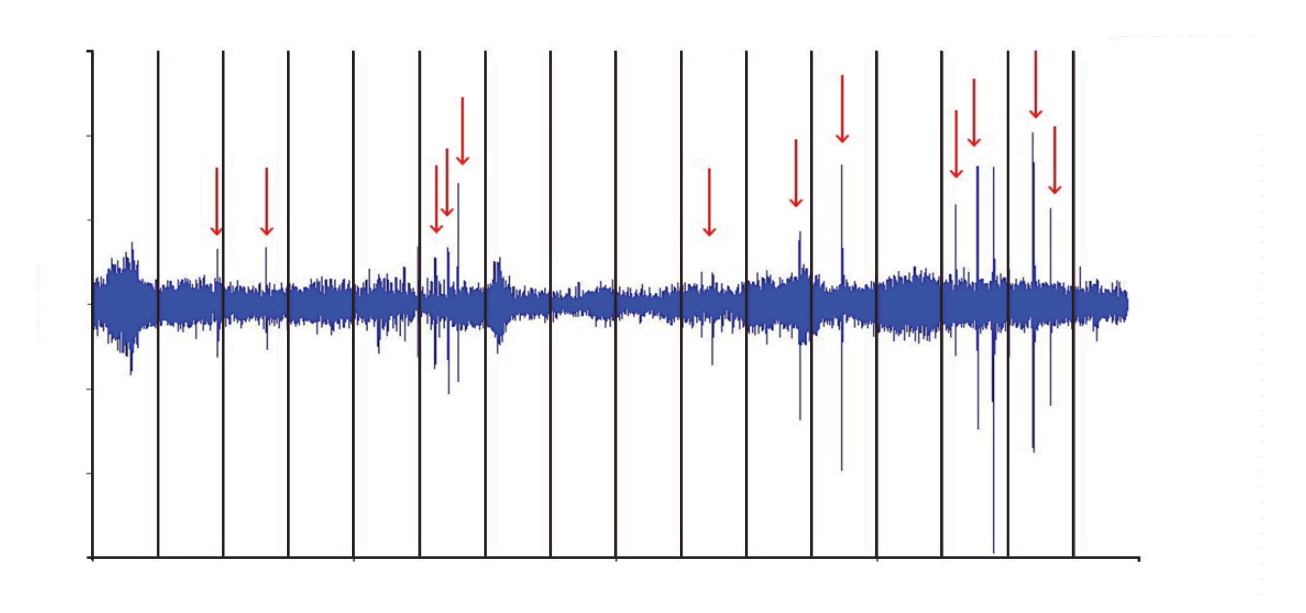 Figure 8. Impacting and looseness&nbsp;in the vibration signature