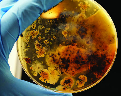 Micorbial contaminants