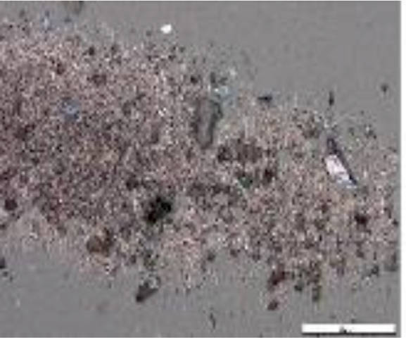 Oil analysis particle counting fig 4