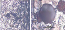 Figure 7. Photomicrographs of small burned holes on the surface filter core (200x and 1,000x magnification) 