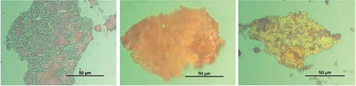 Figure 3. Ferrogram photomicrographs of the turbine oil particles in different samples (1,000x magnification) 