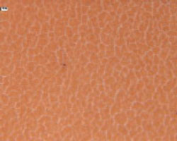 This photomicrograph shows varnish material on an analysis membrane (0.45-micron porosity) at 100x magnification