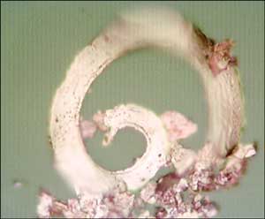 Figure 5. Ferrographic Analysis (top) Shows a Large Concentration of Abrasive Silica in the Grease. The Ferrogram on the bottom Shows Severe Cutting Wear. This Information Helps Identify the Root Cause of Premature Bearing Failures.